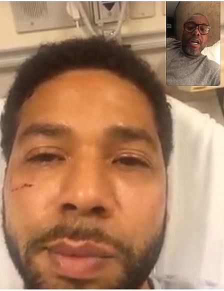 Police say Smollett cut his own cheek to make it look like he had suffered injuries in the attack. He is shown in a hospital bed selfie FaceTiming Lee Daniels, the show's creator, hours after the attack 